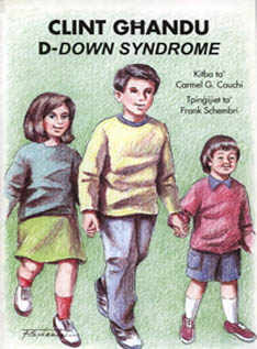 Clint għandu d-Down Syndrome 